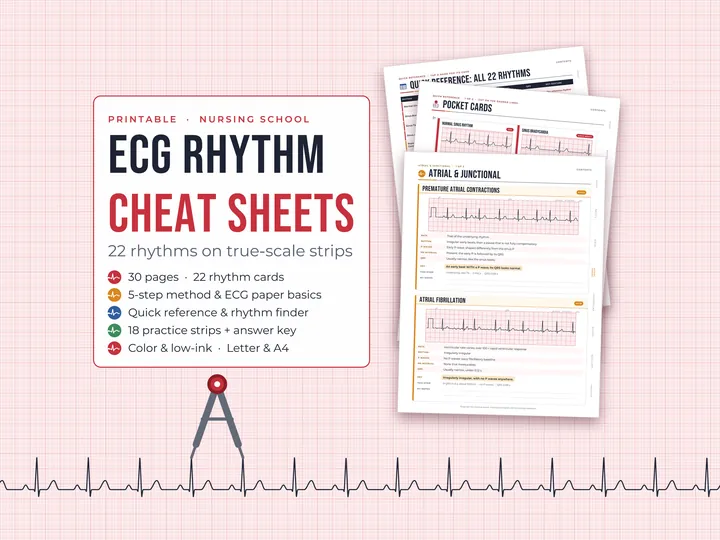 ECG Rhythm Cheat Sheets